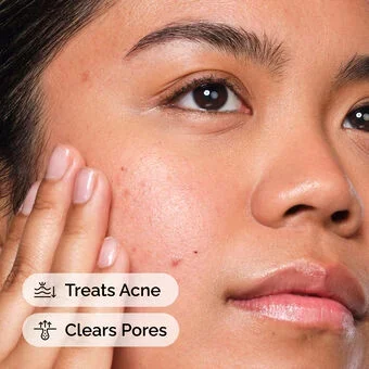 The Ordinary Salicylic Acid 2% Serum 30ml